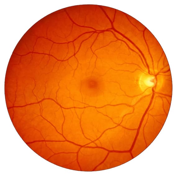 Retina Services